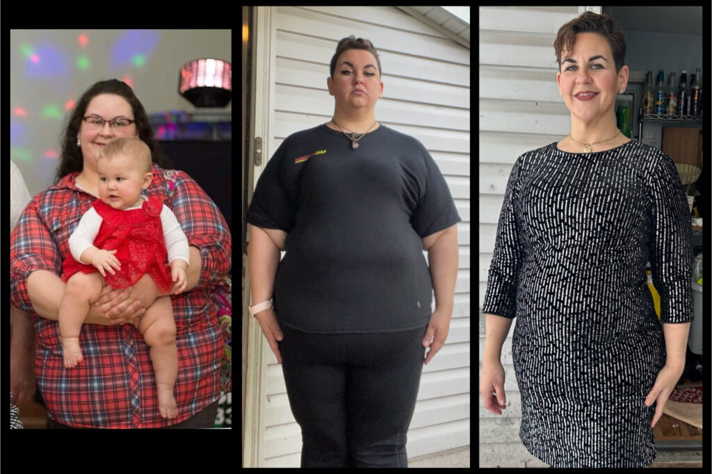 Lackawanna County native Julianna Morse, seen here during phases of her weight-loss journey, has dropped 160 pounds in recent years while getting ʼһ, nutritional, and other support at The Wright Center for Community ʼһ.
